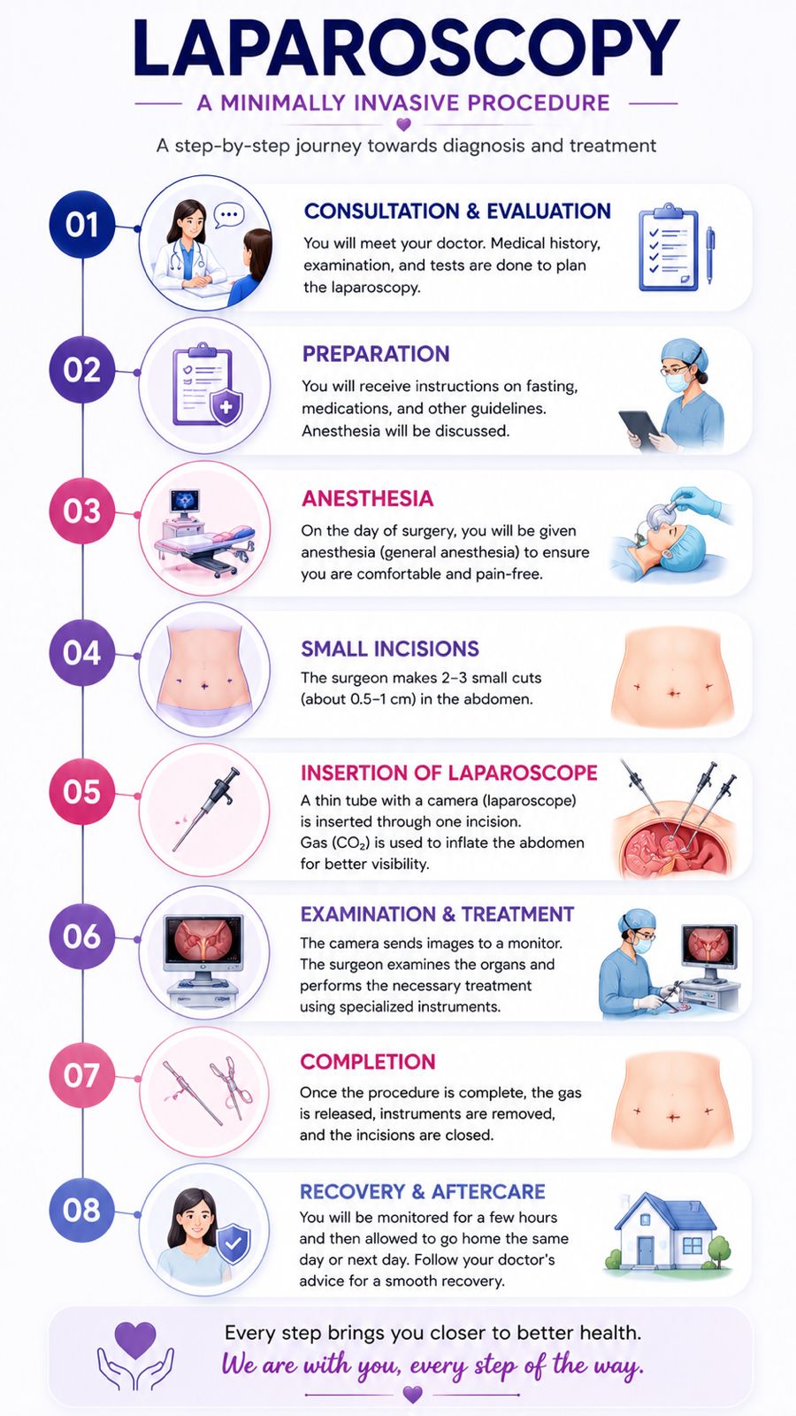 Laparoscopy Process Chart